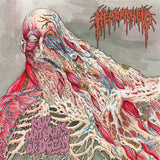 Hemorrhoid - Raw Materials of Decay